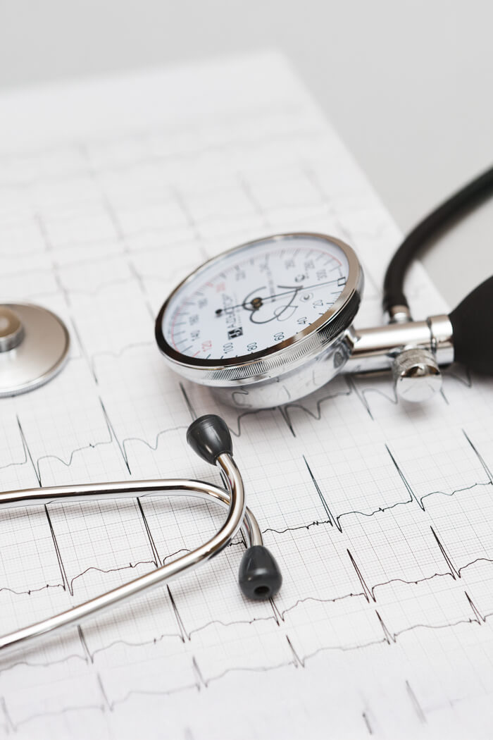 cardiologia. hospital recoletas salud marbella