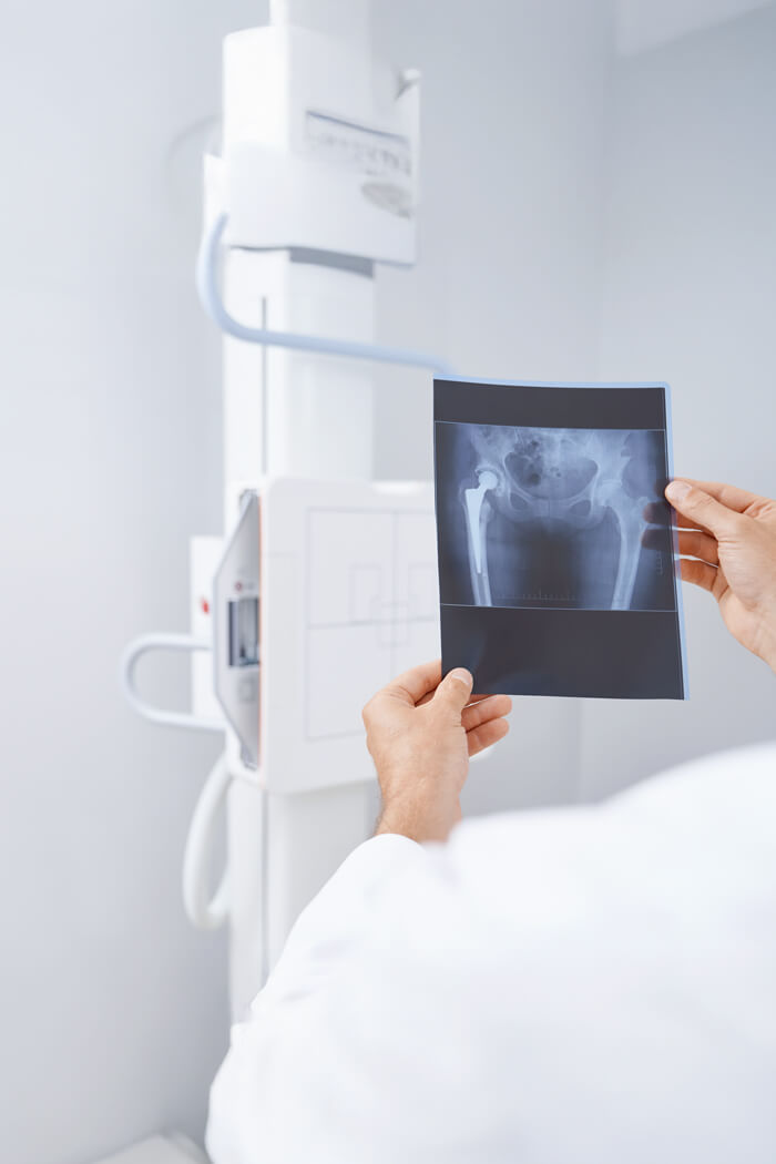 radiologie. krankenhaus recoletas salud marbella