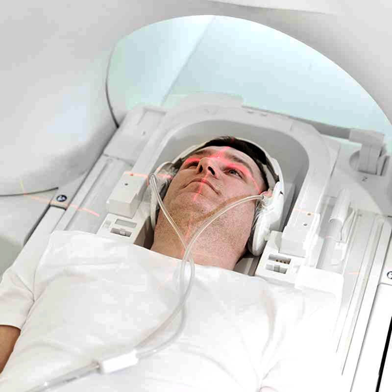 neurocirugia-hospital-recoletas-salud-marbella